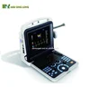 Full-digital beam forming left/right kidney measurement ultrasound machine