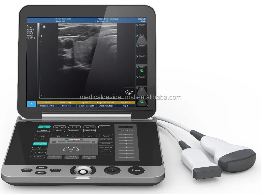 15mhz Frequency Usb Ultrasound Probe For Laptop/portable Ultrasound