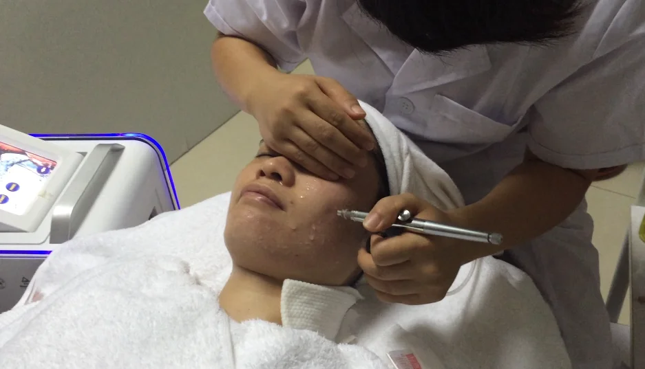 AYJ-Y80 Best selling product  introduction oxygen jet peel machine equipment