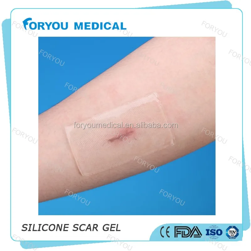 scar removal silicone sheets