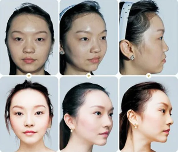 bleach cream for dark spots on face