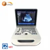 Notebook Full Digital Veterinary Pregnancy Scanning Laptop Ultrasound Equipment