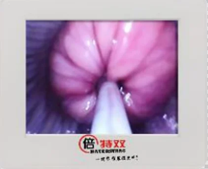 QQ20190424110124