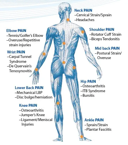 Laser Therapy Trigger Points Detox relief laser therapy class iv laser high power Laser Therapy Trigger Points Detox relief laser therapy class iv laser high power