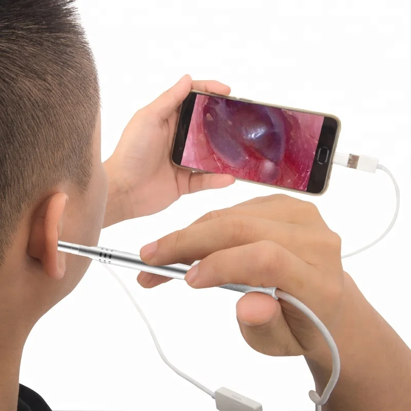 Видеокамера на ухо. Камера ушки. Эндоскоп с камерой ухо. Отоскоп с камерой. Ушная камера.