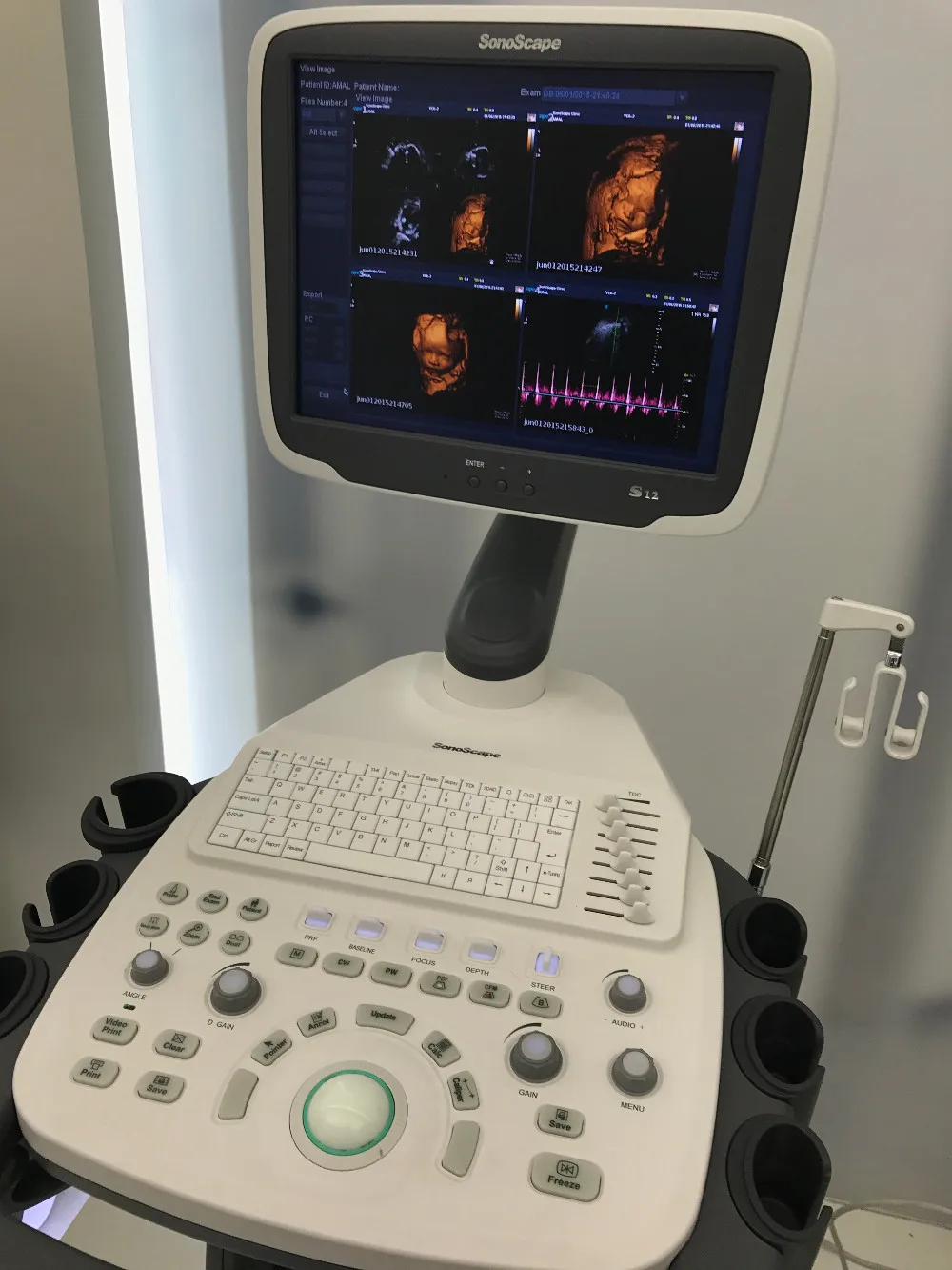 3d 4d Versatile Sonoscape S12 Color Doppler Ultrasound To Ob/gyn ...