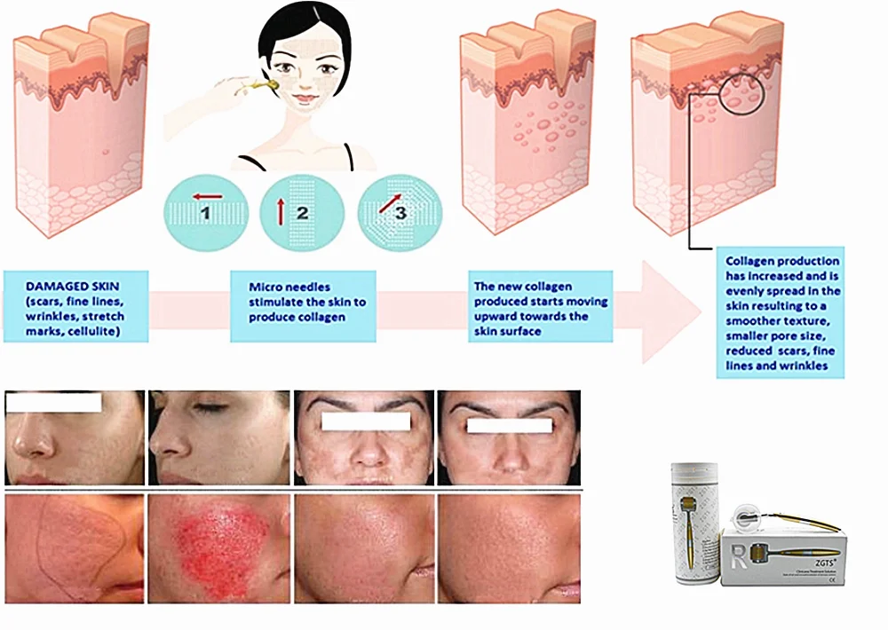 dermarelief图片