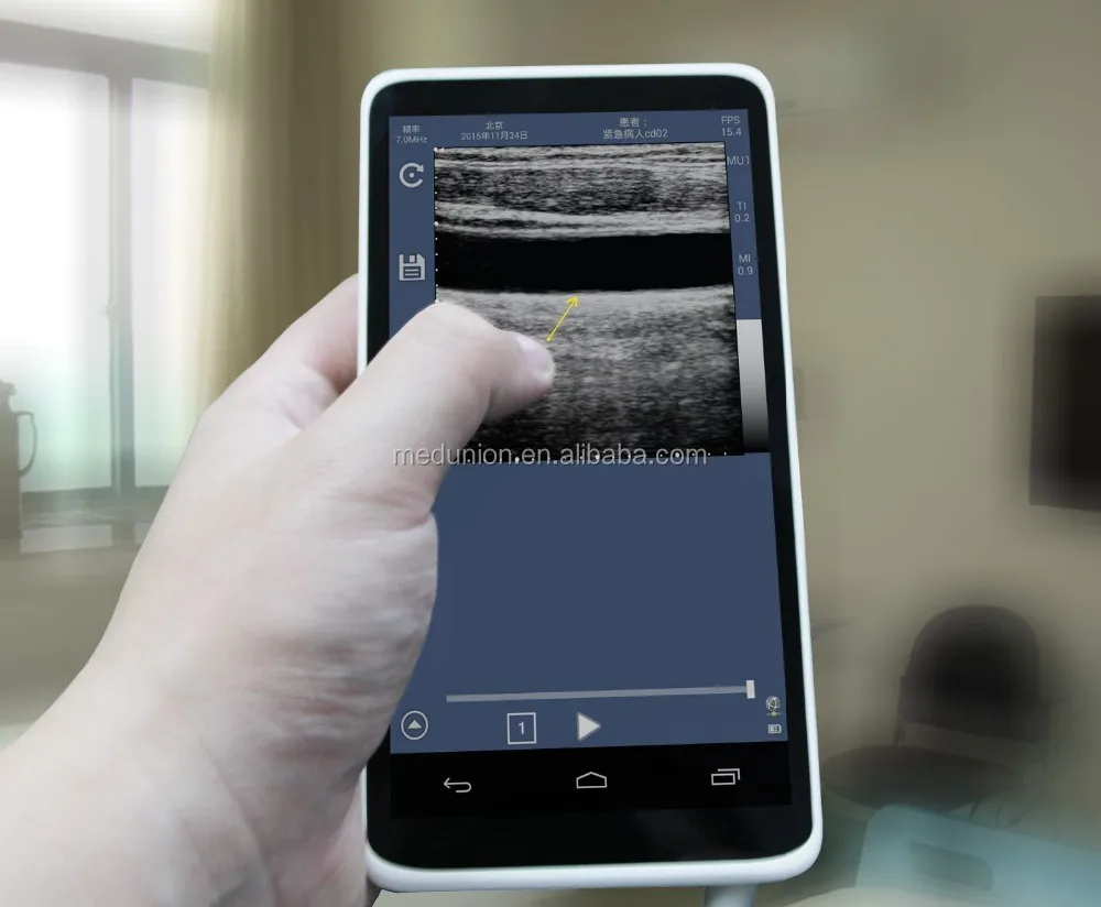 Mini Sized Cheapest Portable Ultrasound Scanner Machine / Wireless
