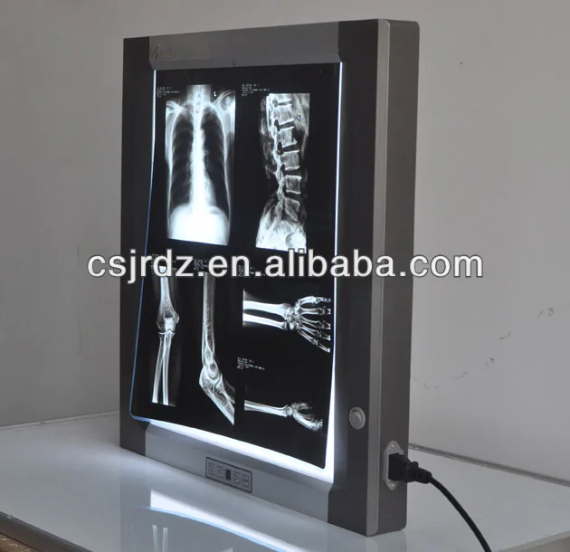 
single bank x ray film viewer, backlight LED technology 