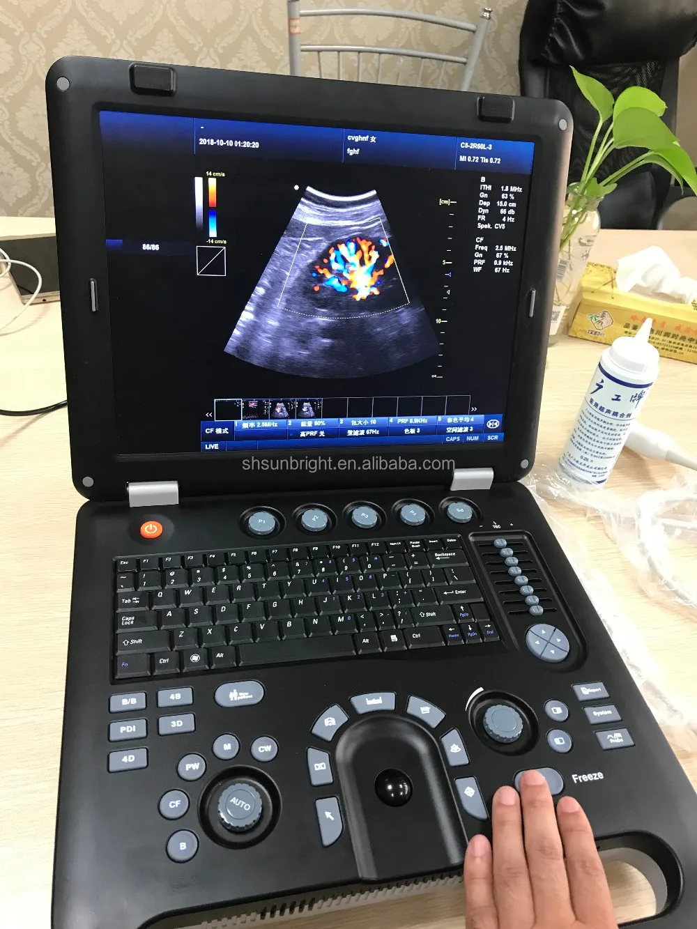 at home doppler pregnancy