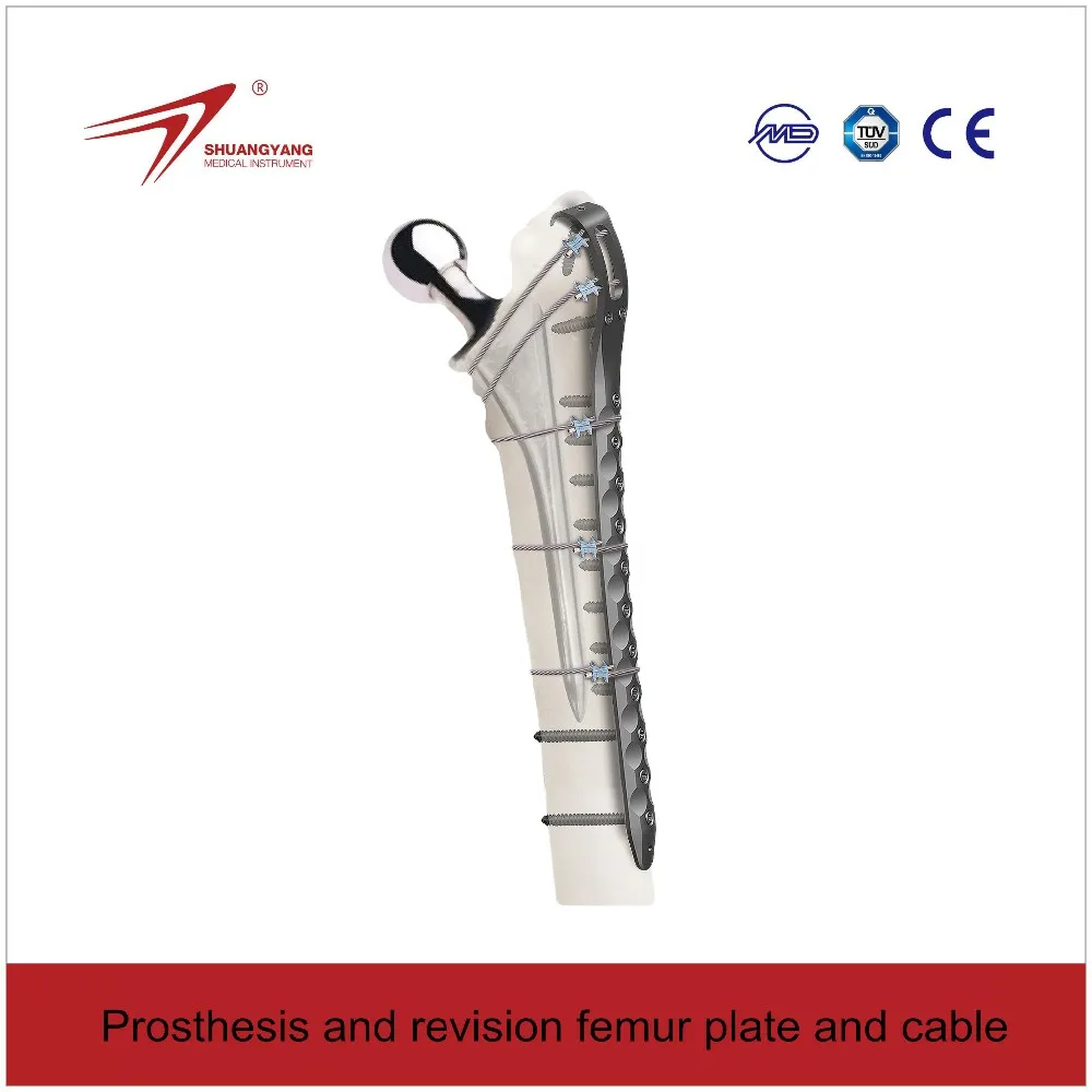 Titanium cable for prosthesis and revision femur plate