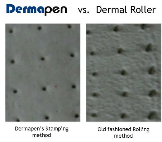 Derma pen and derma roller2.jpg