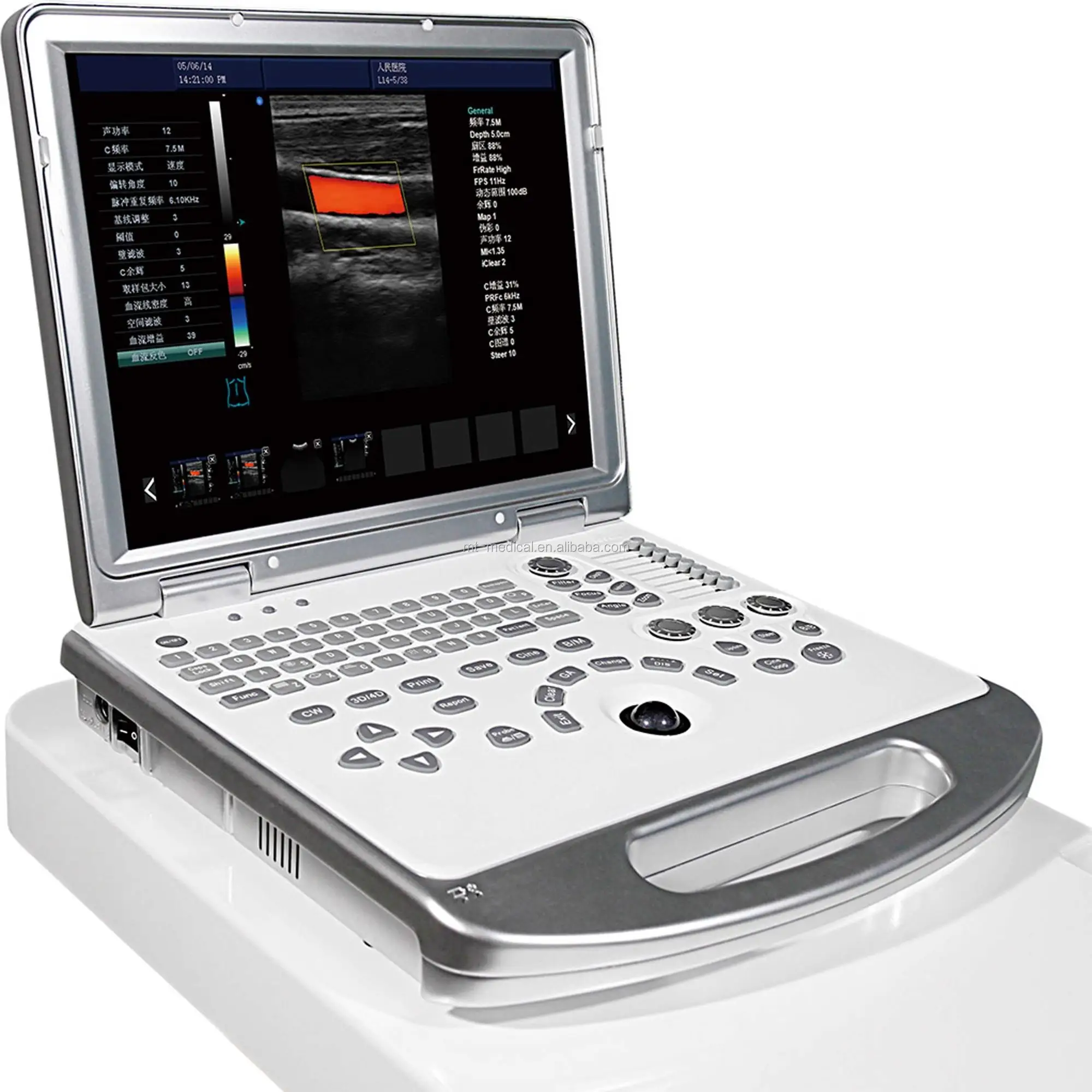 Digital Portable Ultrasound Scanner Diagnostic System For Sale