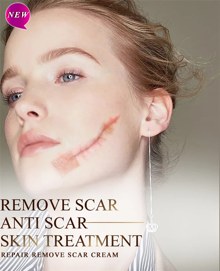 RtopR brand remove Scar Anti Scar skin Treatment repair remove scar cream