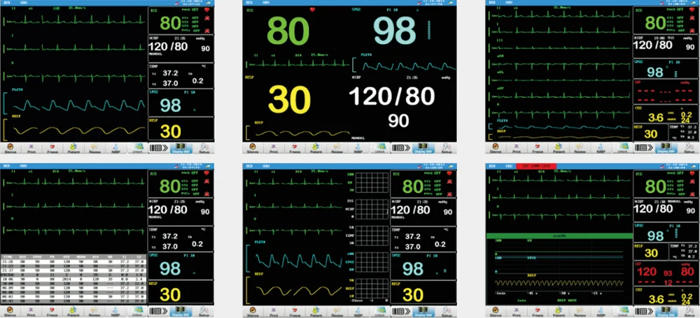 12inch Screen Monitor multiparameter Veterinary Patient Monitor