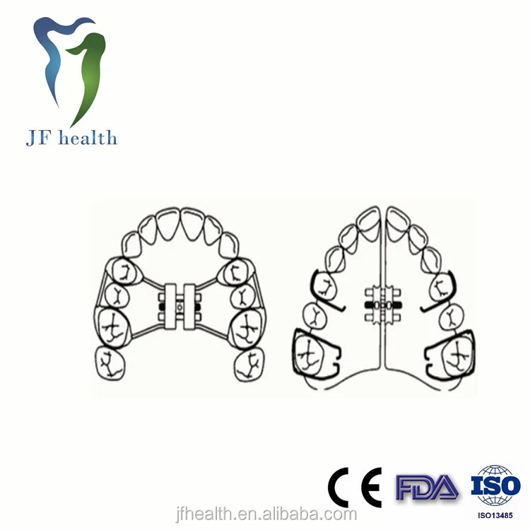 The Expanders Pureline Orthodontic Expansion Key Tool - Set Of 5 Dental ...