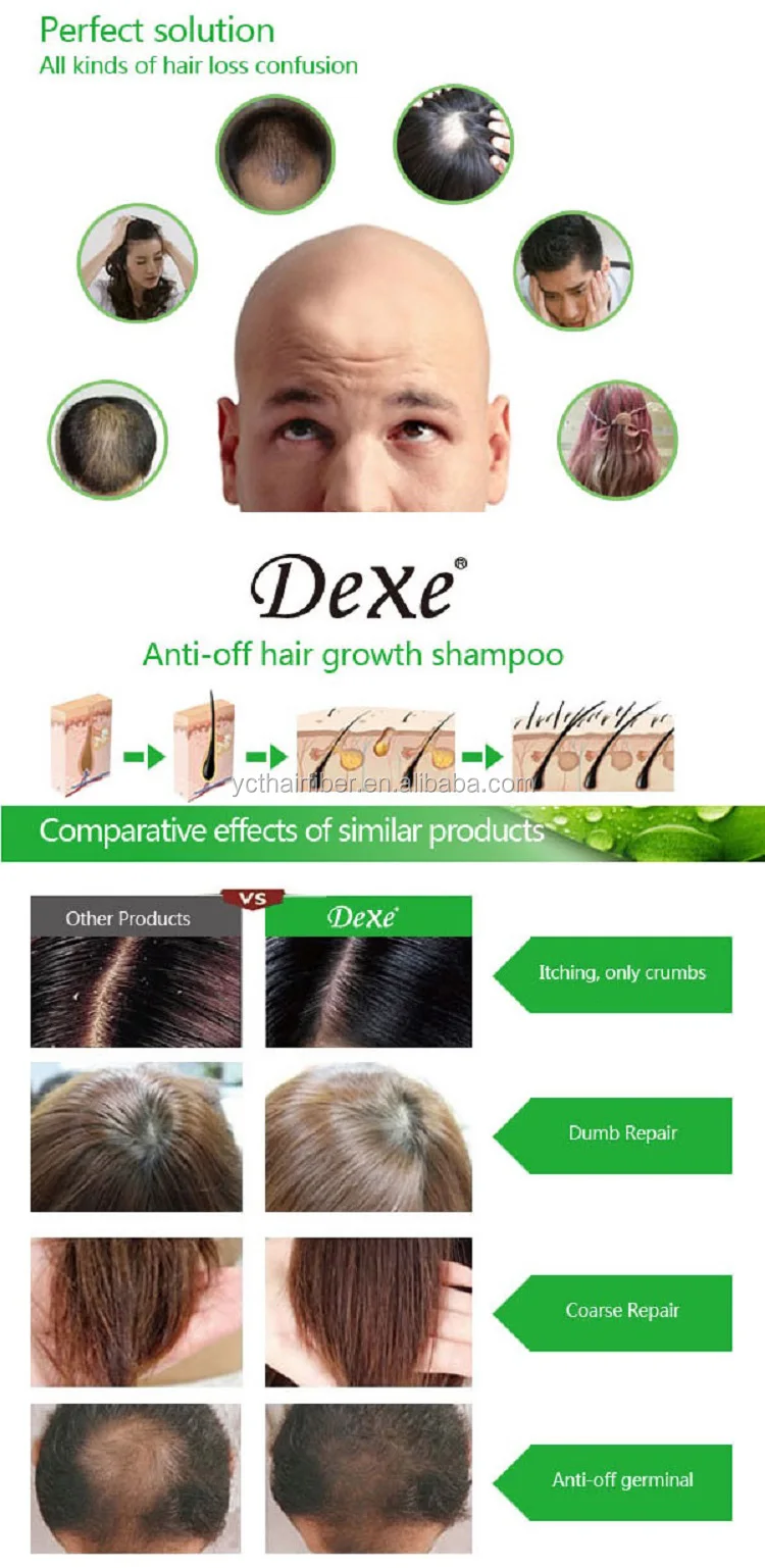 Chinese Herb Formula Anti hair Loss Hair Growth Shampoo Private Label