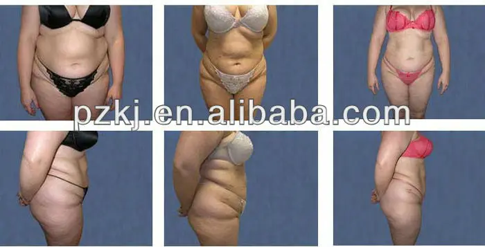 before and after.jpg