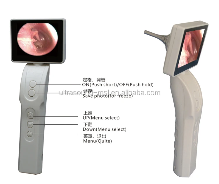 Factory Price Endoscope Camera Digital Video Otoscope/nasal Endoscope Veterinary Buy Endoscope