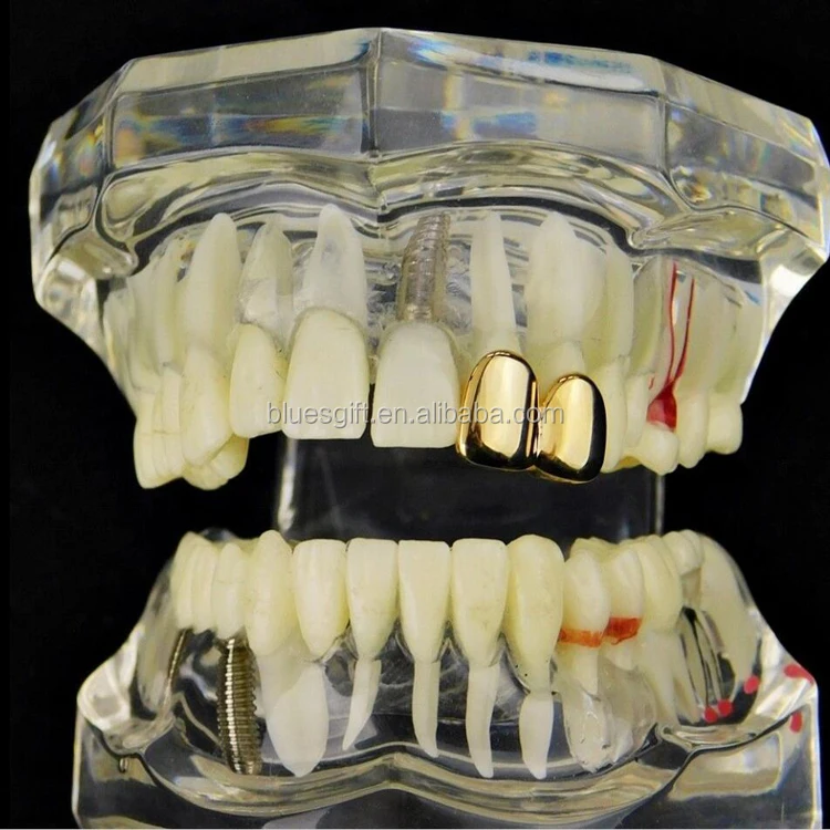 Титановая Пикса сплошная зубы. Two tooths