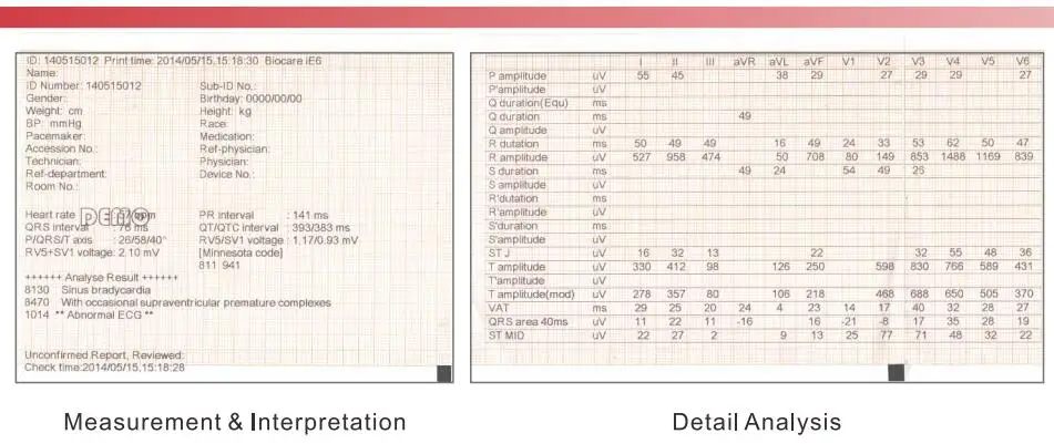Low Price For 6 Channel Multichannel Ecg Machine