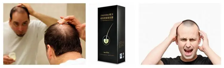 SOST Supply Wholesale Top Quality Pure 99% Hair Loss Minoxidil.jpg