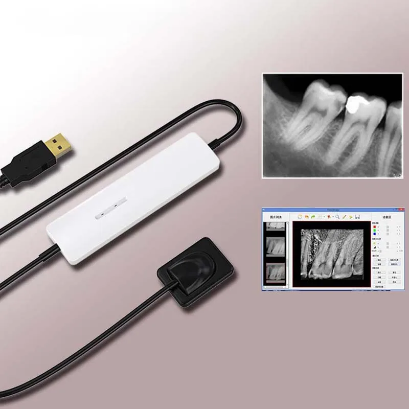 2020 New Dental Digital X Ray Sensor Dental Usb Rvg Buy Xray Sensor