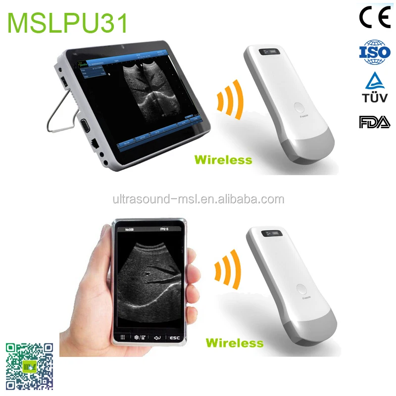 gram machine packing 5 Mslpu31z Wireless Equipment Medical Portable Ultrasound