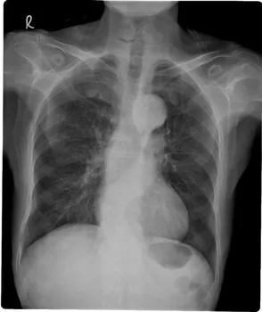 xray of gay sex act funtai shemales