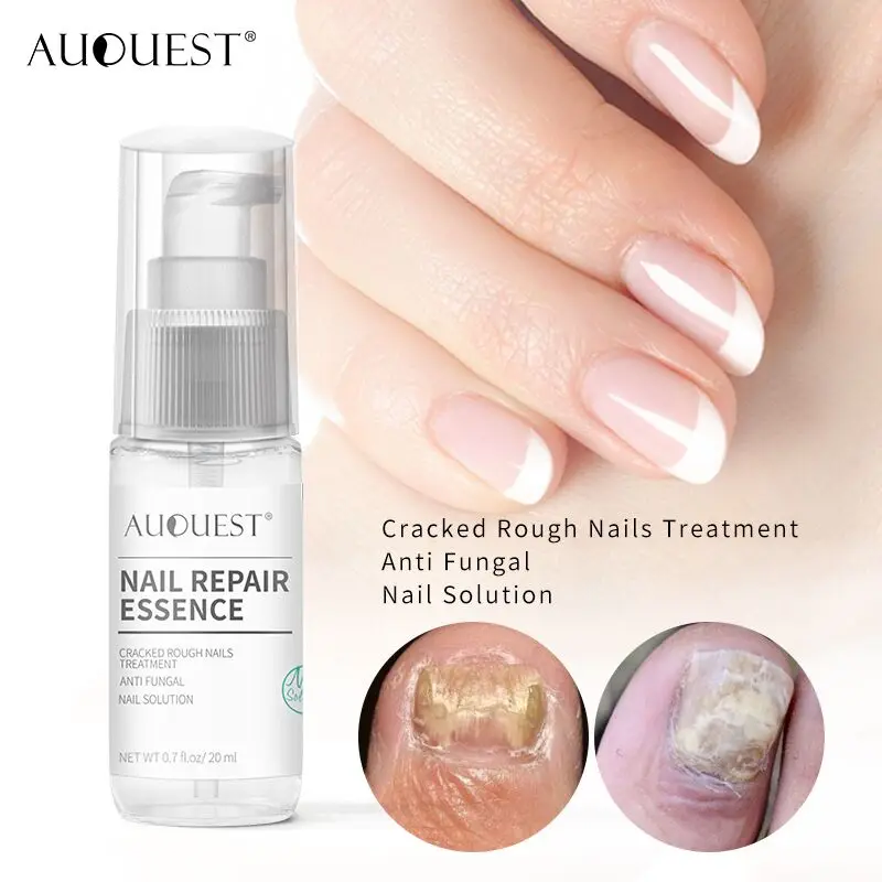 Wholesale Auquest Brand Natural Organic Nail Care Paronychia Fungal Nail  Treatment Nourishing Repair Nail Serum Buy Nail Serum,Nail Repair,Fungus Nail  Treatment Product On | 1pc Nails Repairing Serum Nourishing Nails Essence  Nail