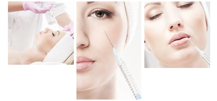 Top-Q super ultra deep line 2ML hyaluronic acid dermal fillers benefits in skin care