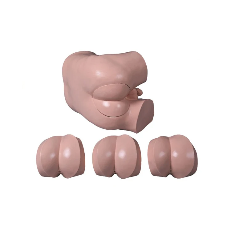 examen rectal digital de próstata