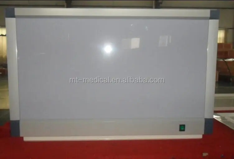 Negatoscope Double X-ray Film Viewer Price