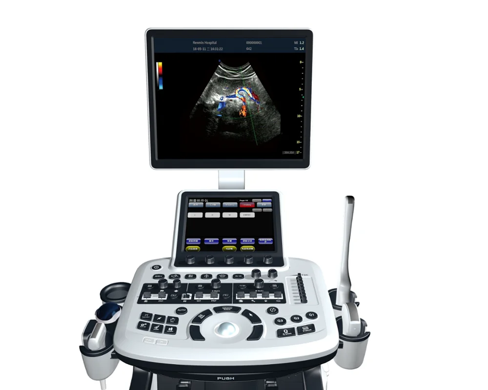 Cheap hospital best ultrasoundmachine 3d 4d ultrasound machine same as DC 8