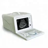 /product-detail/cheap-price-hot-sale-medical-portable-black-and-white-ultrasound-b-scanner-60790350162.html