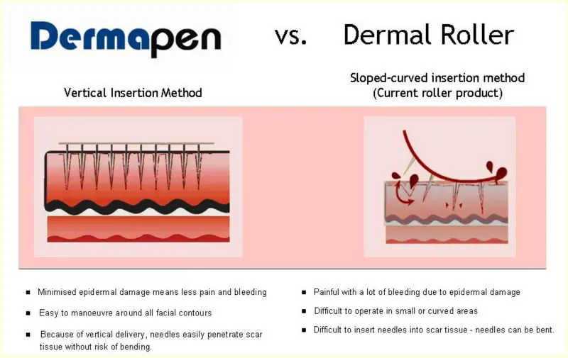 Derma and derma roller 1.jpg