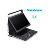 High-Performance Color System PC platform 128 Elements Laptop Sonoscape E2