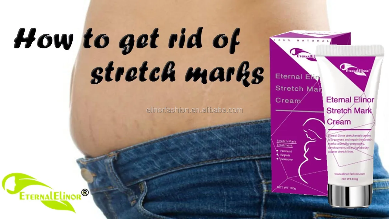 stretchmark12.jpg