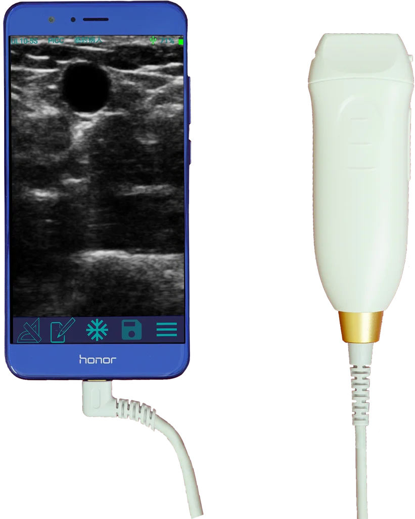 Pocket Sized Handheld Medical Pregnancy Ultrasound Scanner Device