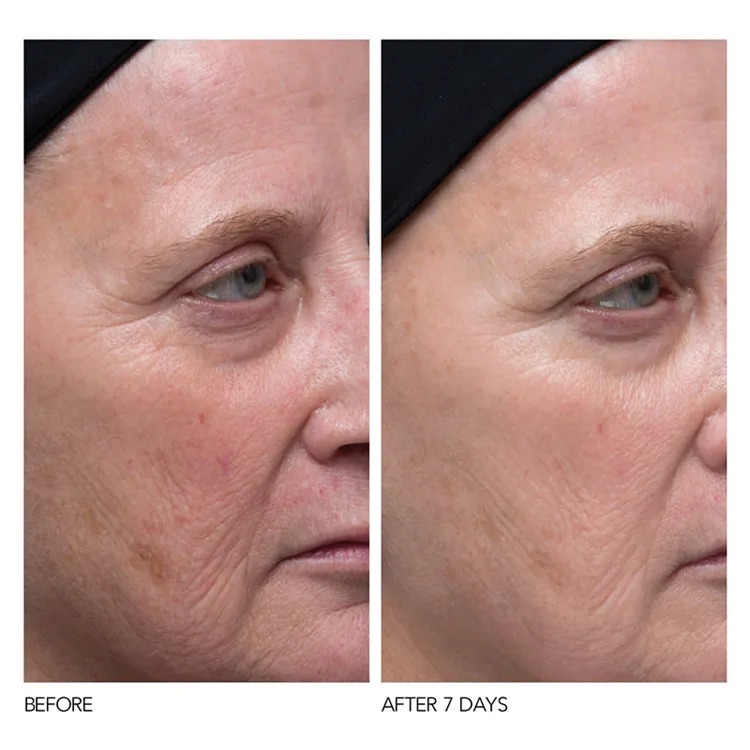 retinol cream 11.jpg