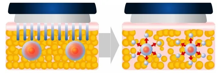B0105 Portable Medical Ultra Cavitataion RF Vacuum Weight Loss Slimming Machine For Sale