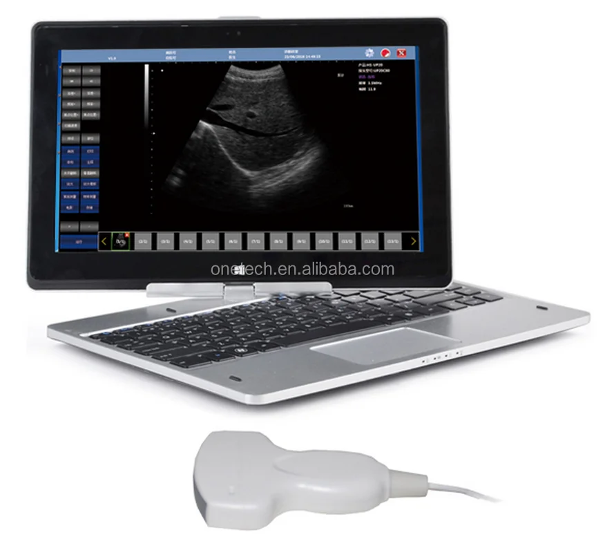 Latest Developed Usb Ultrasonic Transducer Type Scanner / Portable Handheld Ultrasound Probe For
