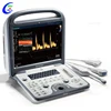 Sonoscape Cardiac Echocardiography, Sonoscape S6 Portable Echo Machine