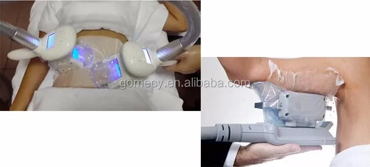 Cryolipolysis cool shaping fat lose device at home.jpg