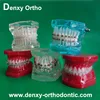 High-quality beautiful dental supplier transparent orthodontic model