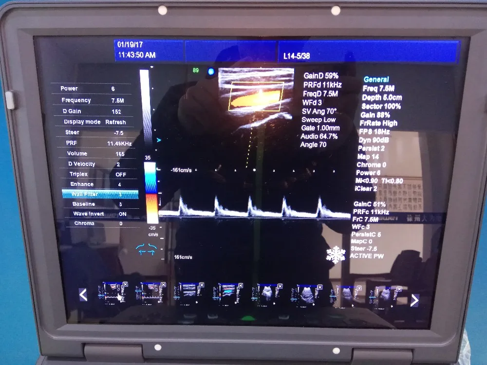 Doppler color Ultrasonido equipos portable ipad ultrasound Scanner Hospital Equipment