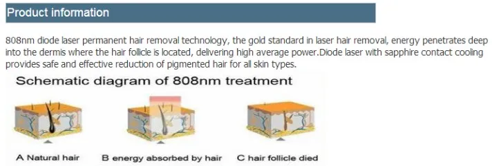 300w 500w 600w808nm Diode Laser Hair Removal Machine