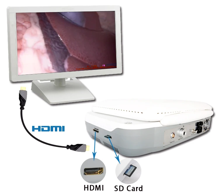 Flexible Ent Endoscope Manufacturer Buy Flexible Ent Endoscope