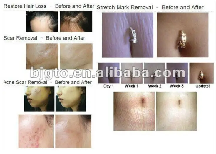 before and after 2.jpg