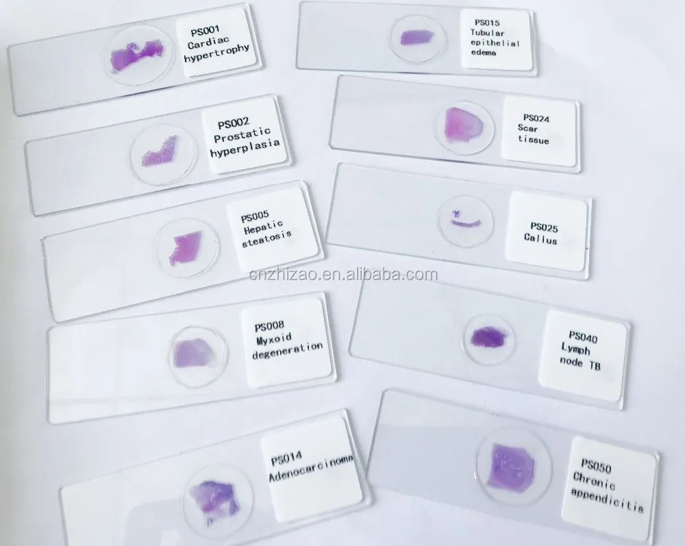 Humanos Individuales Sistema Patologia Preparado Portaobjetos De Microscopio De Humanos De Patologia Buy Juego De Diapositivas Para Microscopio Preparado Juego De Diapositivas Para Microscopio Preparadas Para Patologia Juego De Diapositivas Para